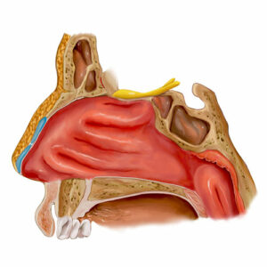 Turbinate Hypertrophy - Raleigh Capitol Sinus & Allergy Center